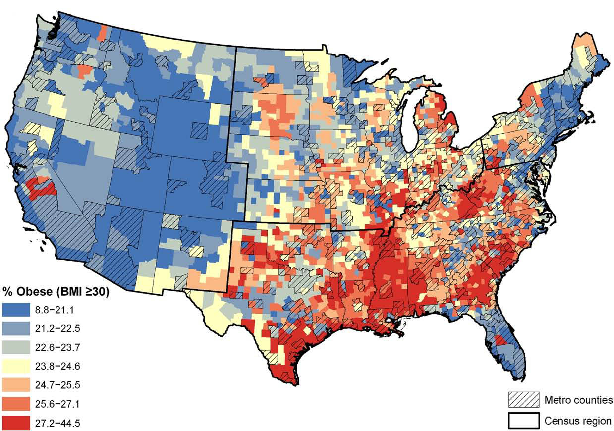 obesity-in-the-united-states